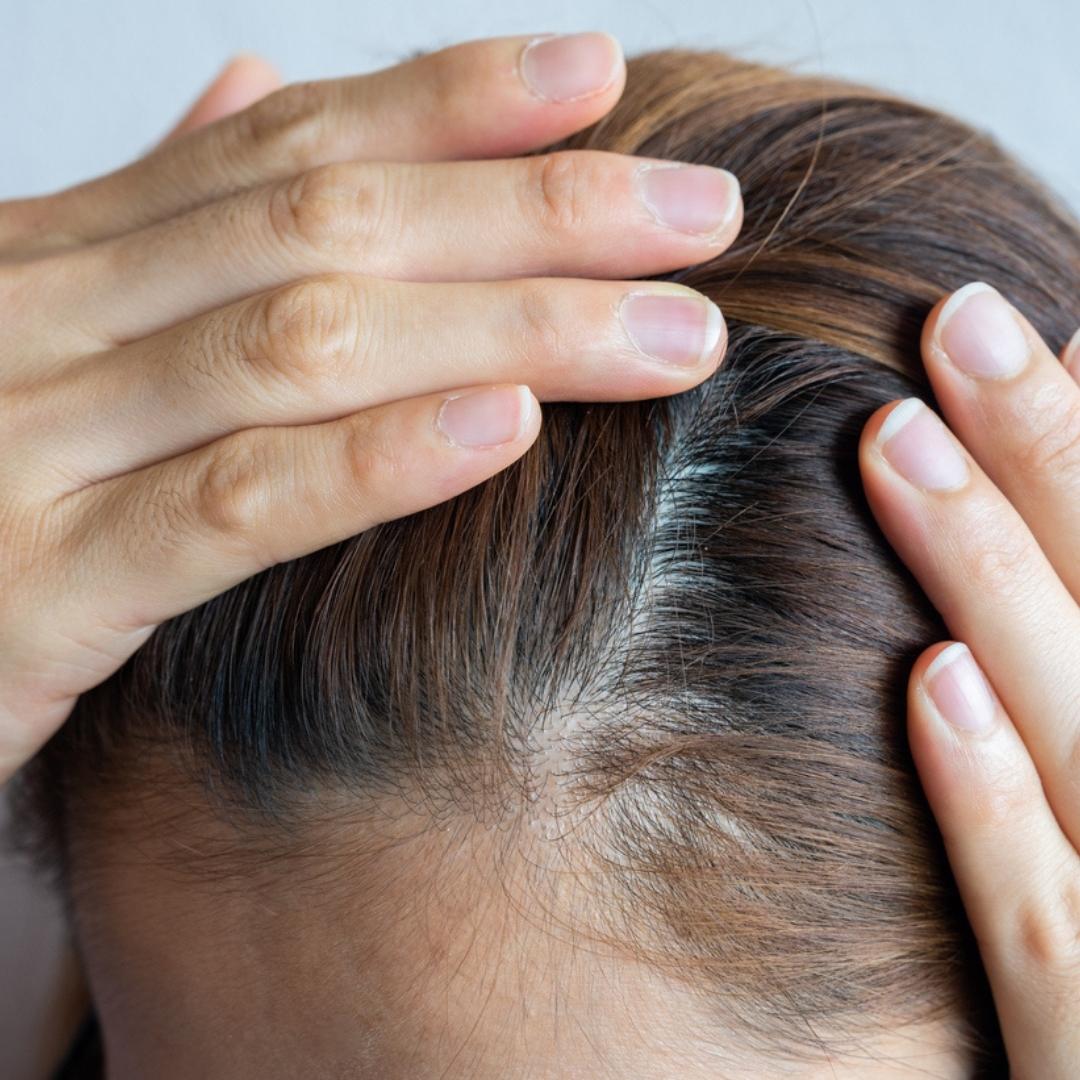 The Importance of Scalp Health - Hair Threads Blog